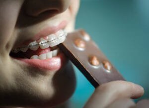 foods to eat with braces