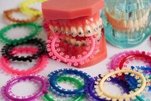 braces color wheel