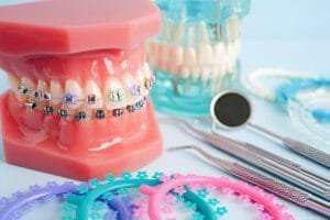 brackets for braces