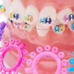 braces color wheel