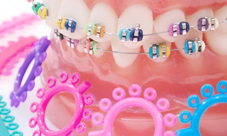 braces color wheel