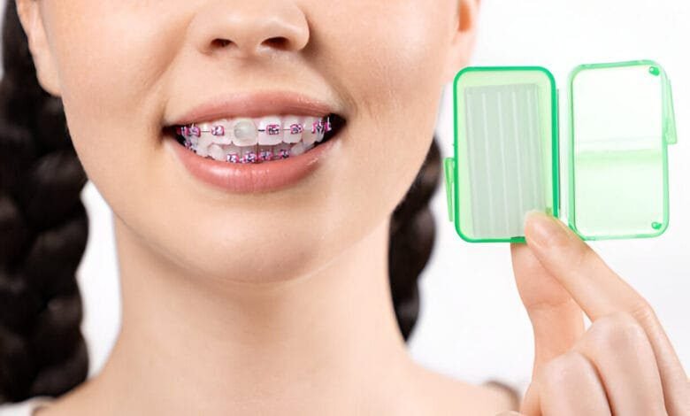 Bite Blocks Braces