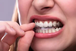 power chain braces