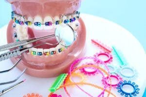 braces color wheel