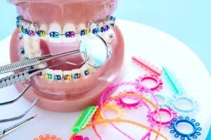 braces color wheel