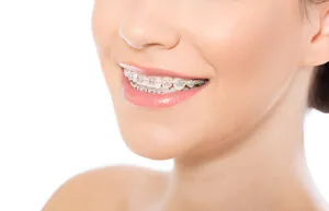 pink color braces