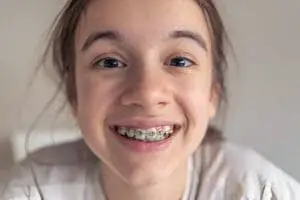 braces colors black