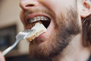 foods to eat with braces
