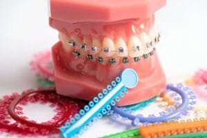 braces color wheel