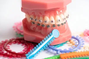 braces color wheel