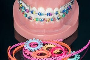 braces color wheel