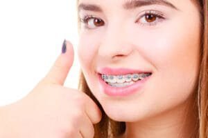 good braces colors