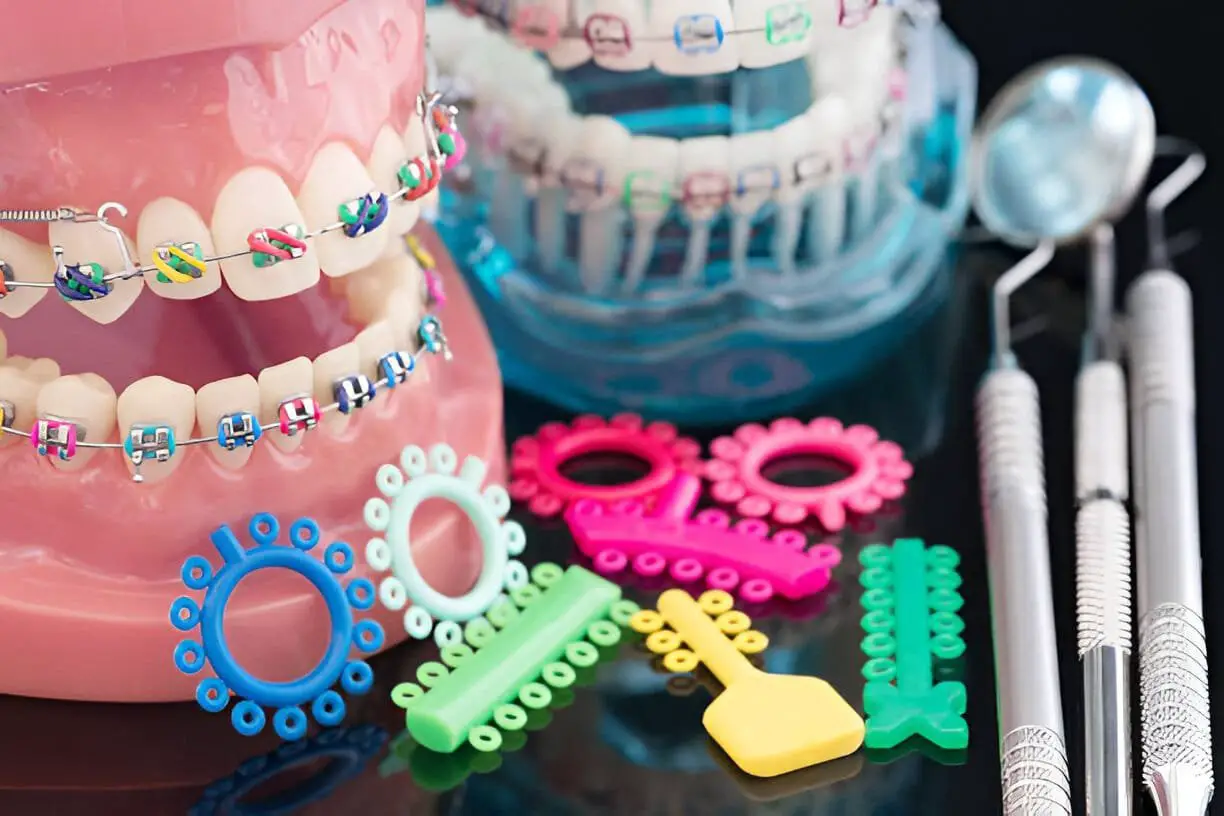 braces color wheel
