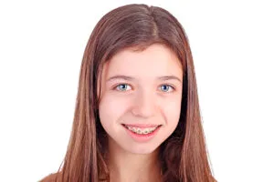 light blue braces
