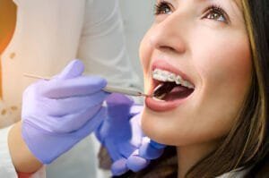 metal teeth braces