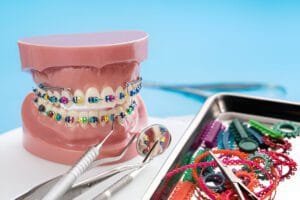 brackets for braces